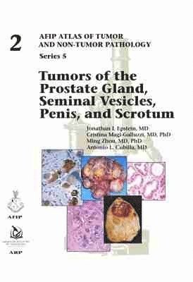 bokomslag Tumors of the Prostate Gland, Seminal Vesicles, Penis, and Scrotum