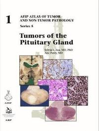 bokomslag Tumors of the Pituitary Gland
