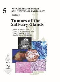 bokomslag Tumors of the Salivary Glands