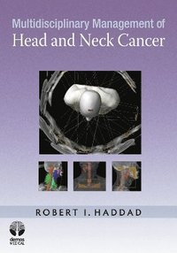 bokomslag Multidisciplinary Management of Head and Neck Cancer