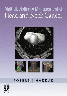 Multidisciplinary Management of Head and Neck Cancer 1