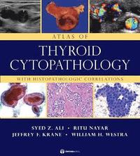 bokomslag Atlas of Thyroid Cytopathology