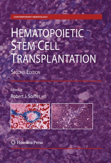 Robert J. Soiffer - Hematopoietic Stem Cell Transplantation, Inbunden