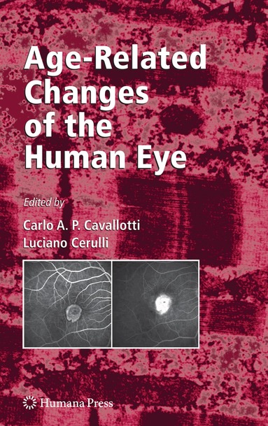 Carlo Cavallotti, Luciano Cerulli - Age-Related Changes of the Human Eye, Inbunden