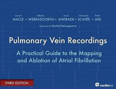 bokomslag Pulmonary Vein Recordings