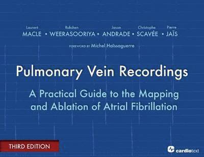 Pulmonary Vein Recordings 1