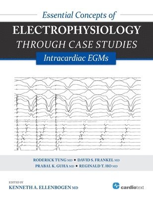 Essential Concepts of Electrophysiology Through Case Studies: Intracardiac EGMs 1