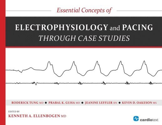 Kenneth a Ellenbogen, Roderick Tung, Prabal Guha, Kenneth a. Ellenbogen, Kenneth A Ellenbogen - Essential Concepts of Electrophysiology and Pacing Through Case Studies, Häftad