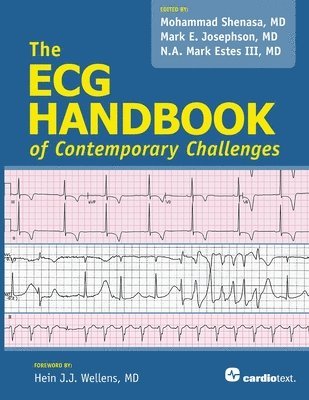 Mohammad Shenasa, Mark E. Josephson, N. A. Mark Estes, Mohammad Shenasa, Mark E. Josephson, N. A. Mark Estes - ECG Handbook of Contemporary Challenges, Häftad