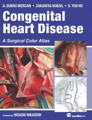 bokomslag Congenital Heart Disease