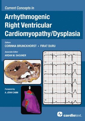 Current Concepts in Arrhythmogenic Right Ventricular Cardiomyopathy / Dysplasia 1