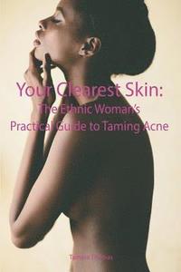 bokomslag Your Clearest Skin: The Ethnic Woman's Practical Guide to Taming Acne