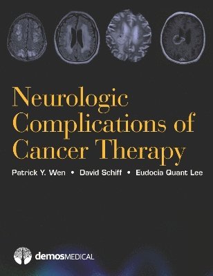 bokomslag Neurologic Complications of Cancer Therapy