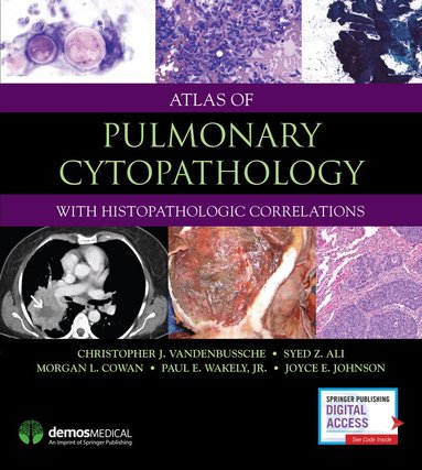 Christopher J. VandenBussche, Syed Z. Ali, Anil V. Parwani, Morgan Cowan, Paul E. Wakely Jr., Joyce E. Johnson - Atlas of Pulmonary Cytopathology, Inbunden
