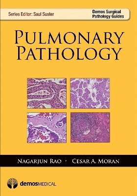 bokomslag Pulmonary Pathology