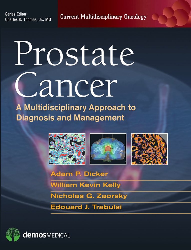 Prostate Cancer