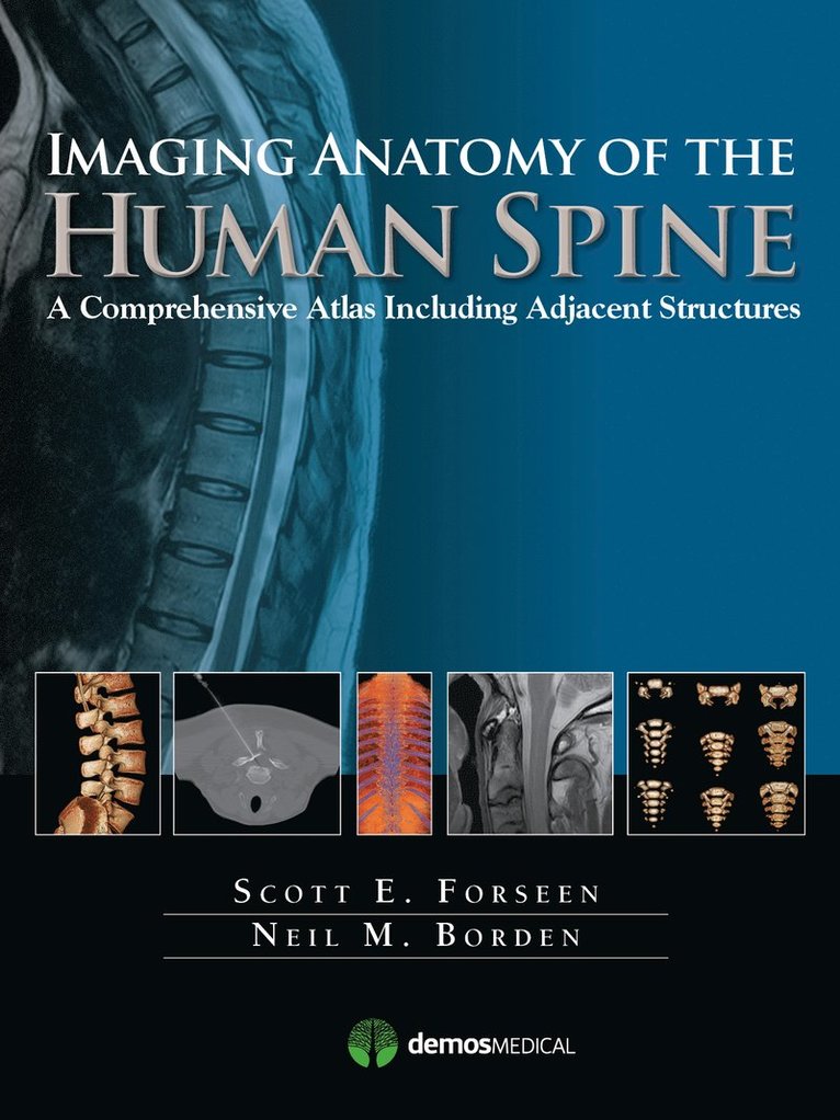 Scott E. Forseen, Neil M. Borden, MD Forseen, Scott E., MD Borden, Neil M., Scott E Forseen, Neil M Borden - Imaging Anatomy of the Human Spine, Inbunden