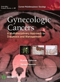 bokomslag Gynecologic Cancers