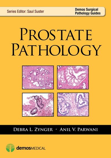 Debra Zynger, Anil V. Parwani, Saul Suster - Prostate Pathology, Häftad