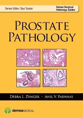Debra Zynger, Anil V. Parwani, MD Zynger, Debra, MD Parwani, Anil V., Anil V Parwani, Saul Suster - Prostate Pathology, Häftad