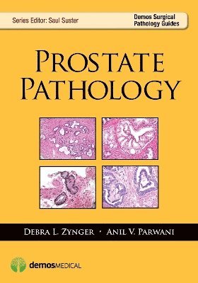 Prostate Pathology 1