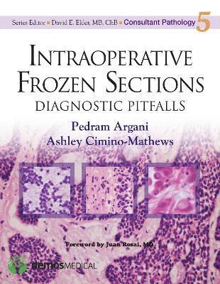 Intraoperative Frozen Sections 1