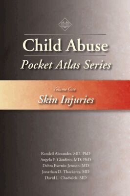 Randell Alexander, Angelo P. Giardino, Debra Esernio-Jenssen, Jonathan D. Thackeray, David L. Chadwick - Child Abuse Pocket Atlas Series, Volume 1: Skin Injuries, Häftad