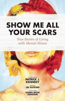 Show Me All Your Scars 1