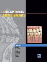 bokomslag Specialty Imaging: Dental Implants