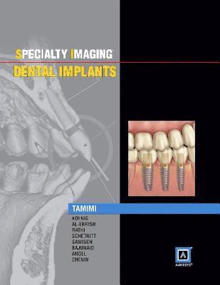 Specialty Imaging: Dental Implants 1