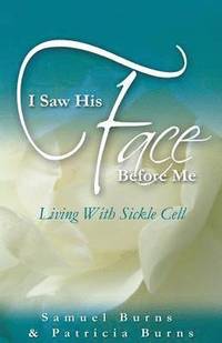 bokomslag I Saw His Face Before Me - Living with Sickle Cell Anemia