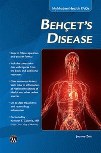 bokomslag Behcets Disease