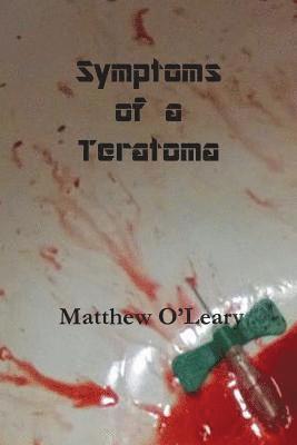 Symptoms of a Teratoma 1