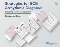 bokomslag Strategies for ECG Arrhythmia Diagnosis