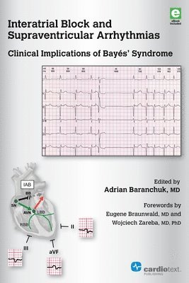 bokomslag Interatrial Block and Supraventricular Arrhythmias