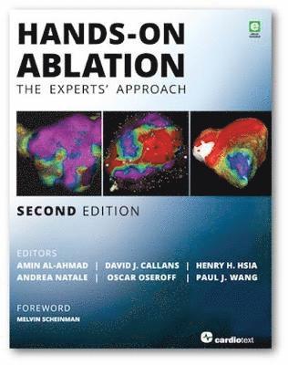 Amin Al-Ahmad, David Callans, Henry H Hsia - Hands-On Ablation, Inbunden