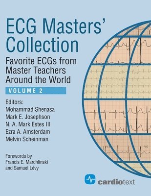 Mohammad Shenasa, Mark E. Josephson, Mohammad Shenasa, Mark E Josephson, N a Mark Estes - ECG Masters Collection, Volume 2, Häftad