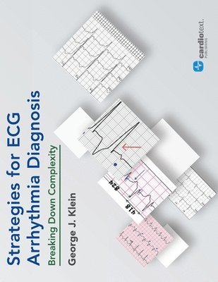 George J. Klein, George J. Klein - Strategies for ECG Arrhythmia Diagnosis, Häftad