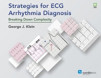 bokomslag Strategies for ECG Arrhythmia Diagnosis