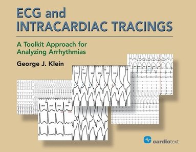 George J Klein - ECG and Intracardiac Tracings, Häftad