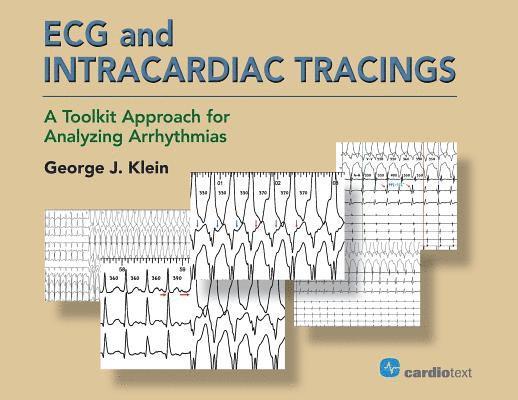 George J Klein, George J. Klein - ECG and Intracardiac Tracings, Häftad