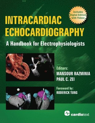 Paul C. Zei, Mansour Razminia - Intracardiac Echocardiography: A Handbook for Electrophysiologists, Häftad