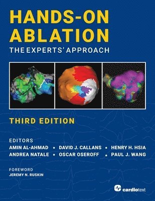 Hands-On Ablation: The Experts' Approach, Third Edition 1