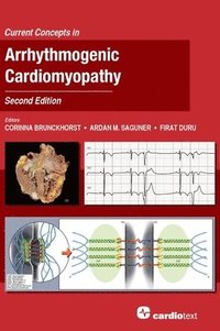 bokomslag Current Concepts in Arrhythmogenic Cardiomyopathy, Second Edition