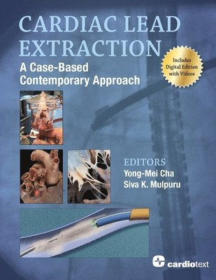 Cardiac Lead Extraction: A Case-Based Contemporary Approach 1