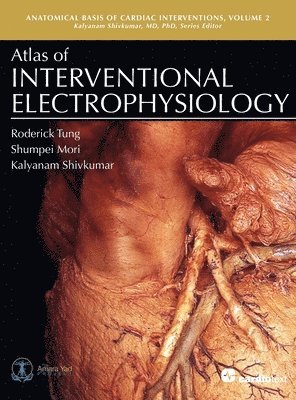 Roderick Tung - Atlas of Interventional Electrophysiology, Volume 2, Inbunden
