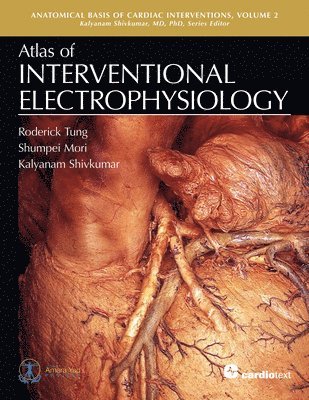 Atlas of Interventional Electrophysiology, Volume 2 1