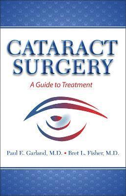 Cataract Surgery 1