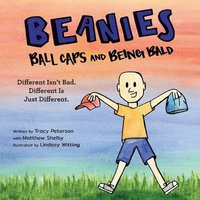 bokomslag Beanies, Ball Caps, and Being Bald: Different Isn't Bad, Different Is Just Different