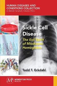 bokomslag Sickle Cell Disease